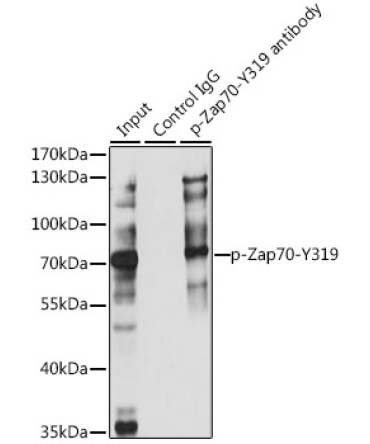 Phospho-ZAP70-Y319 Rabbit Polyclonal Antibody