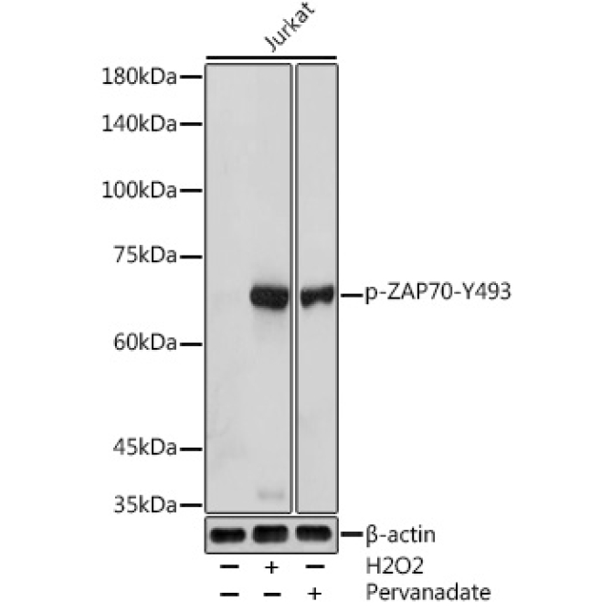Phospho-ZAP70-Y493 Rabbit Polyclonal Antibody