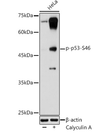 Phospho-p53-S46 Rabbit Polyclonal Antibody