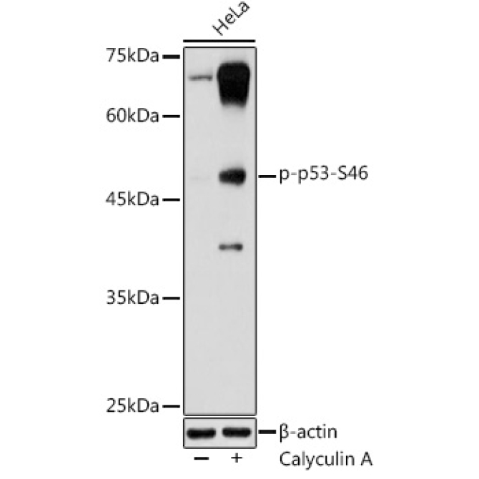 Phospho-p53-S46 Rabbit Polyclonal Antibody