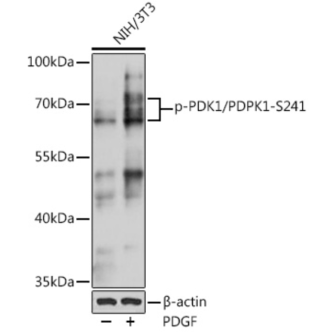 Phospho-PDK1/PDPK1-S241 Rabbit Polyclonal Antibody
