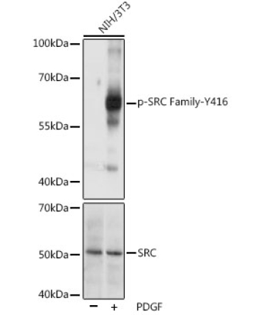 Phospho-SRC Family-Y416 Rabbit Polyclonal Antibody