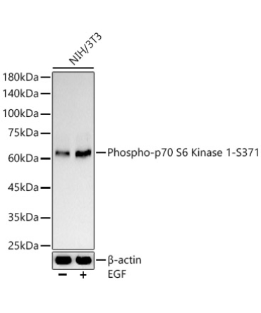Phospho-p70 S6 Kinase 1-S371 Rabbit Polyclonal Antibody