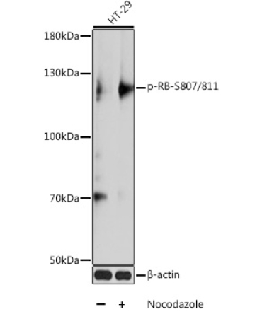 Phospho-RB-S807/811 Rabbit Polyclonal Antibody