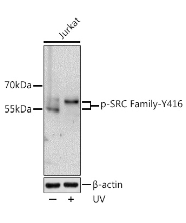 Phospho-SRC Family-Y416 Rabbit Polyclonal Antibody