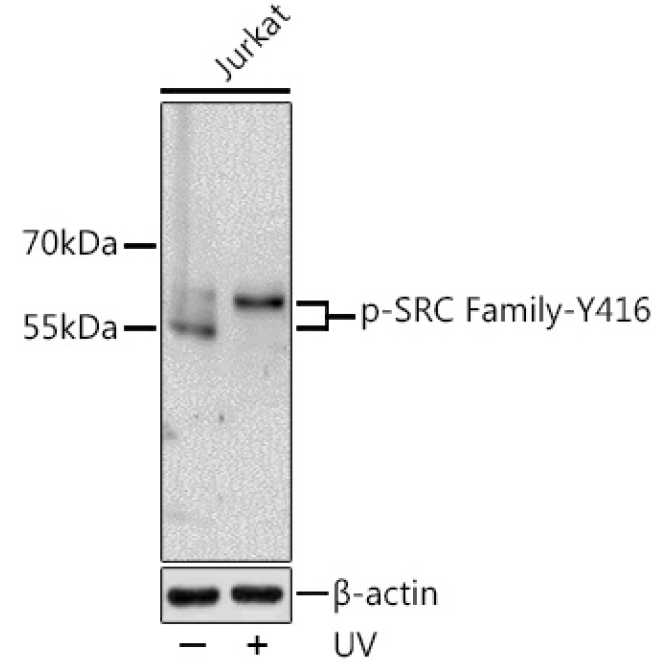 Phospho-SRC Family-Y416 Rabbit Polyclonal Antibody