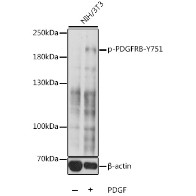 Phospho-PDGFRB-Y751 Rabbit Polyclonal Antibody