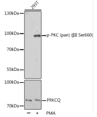 Phospho-PKC (pan) (BetaII Ser660) Rabbit Polyclonal Antibody