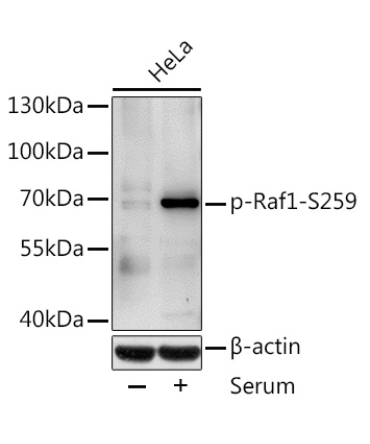 Phospho-Raf1-S259 Rabbit Polyclonal Antibody
