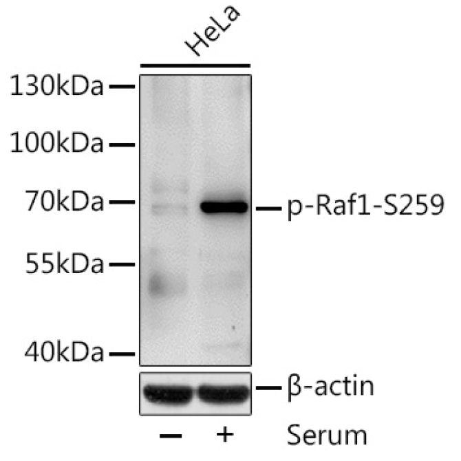 Phospho-Raf1-S259 Rabbit Polyclonal Antibody