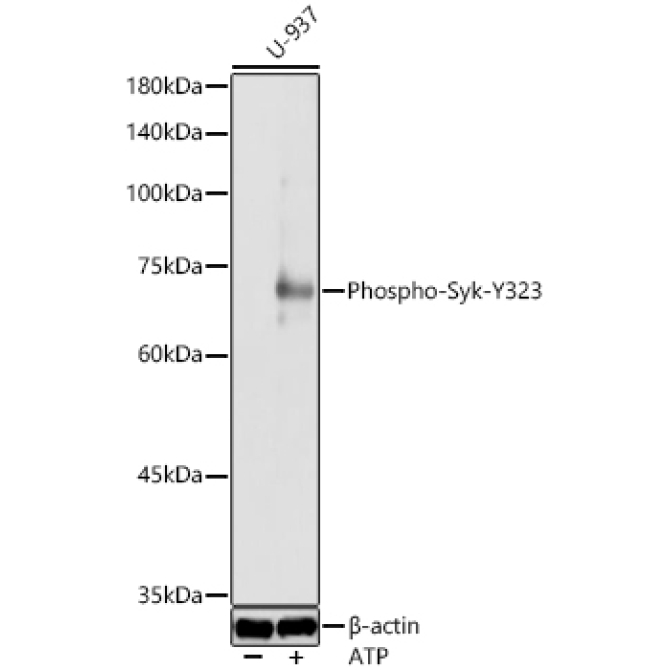 Phospho-Syk-Y323 Rabbit Polyclonal Antibody