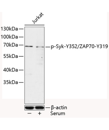 Phospho-Syk-Y352/ZAP70-Y319 Rabbit Polyclonal Antibody