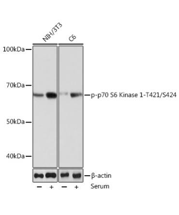 Phospho-p70 S6 Kinase 1-T421/S424 Rabbit Monoclonal Antibody