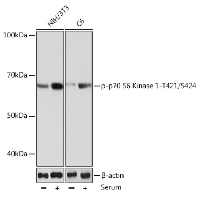 Phospho-p70 S6 Kinase 1-T421/S424 Rabbit Monoclonal Antibody