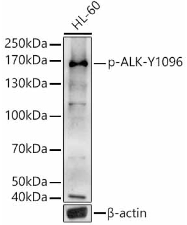 Phospho-ALK-Y1096 Rabbit Polyclonal Antibody
