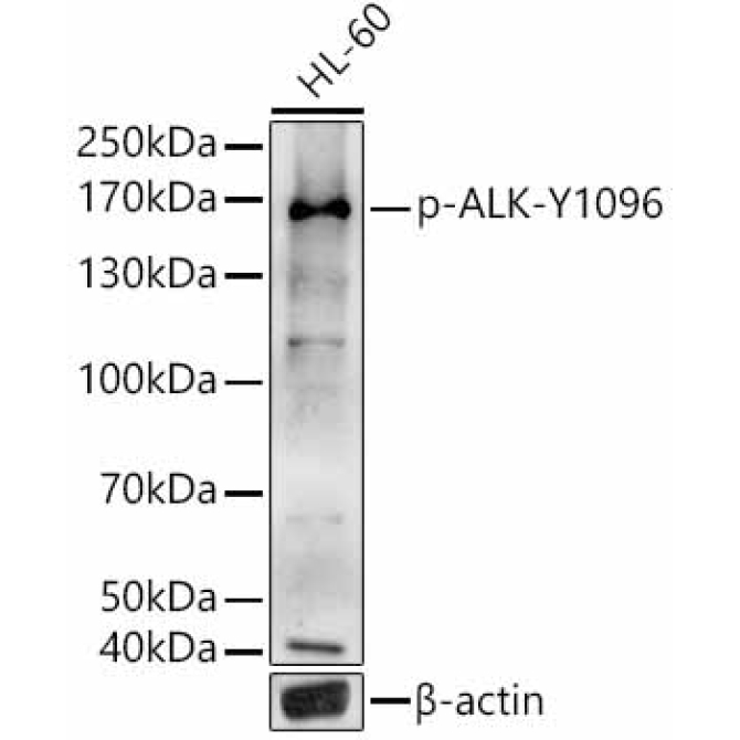Phospho-ALK-Y1096 Rabbit Polyclonal Antibody
