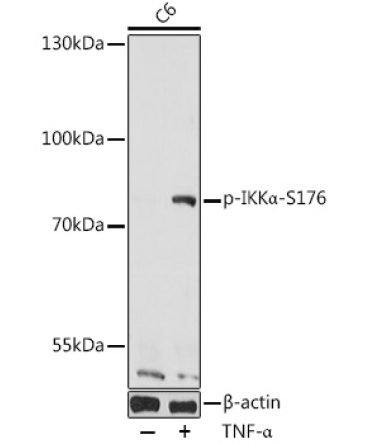 Phospho-IKKAlpha-S176 Rabbit Polyclonal Antibody