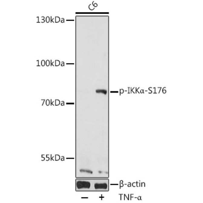 Phospho-IKKAlpha-S176 Rabbit Polyclonal Antibody