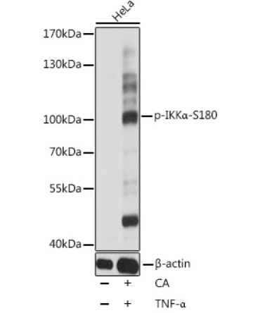 Phospho-IKKAlpha-S180 Rabbit Polyclonal Antibody