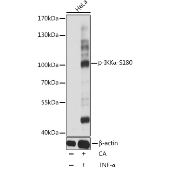 Phospho-IKKAlpha-S180 Rabbit Polyclonal Antibody
