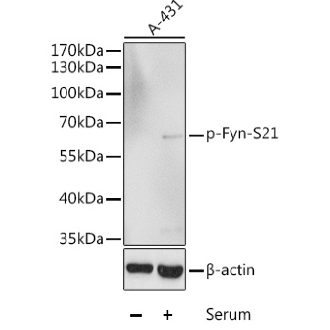 Phospho-Fyn-S21 Rabbit Polyclonal Antibody