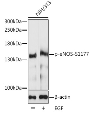 Phospho-eNOS-S1177 Rabbit Polyclonal Antibody