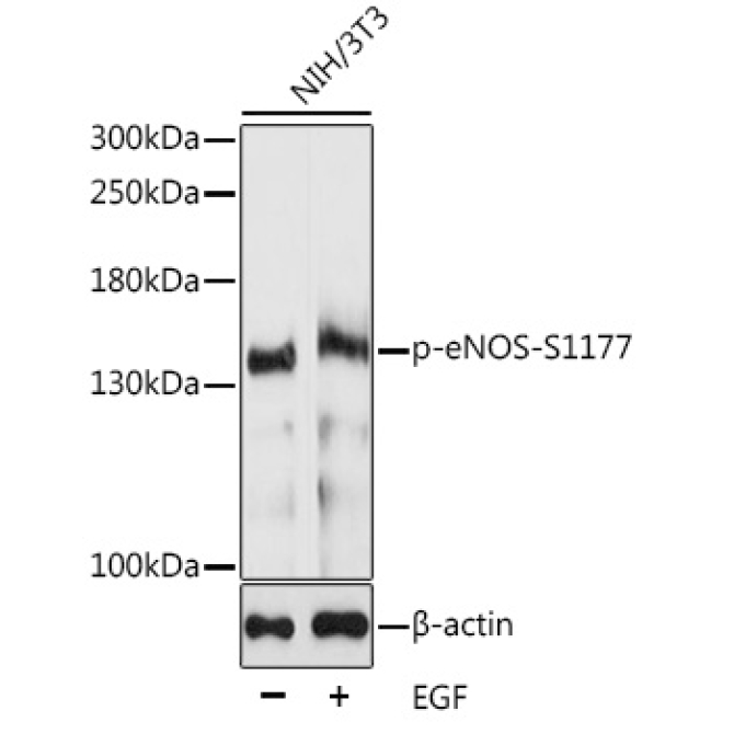 Phospho-eNOS-S1177 Rabbit Polyclonal Antibody