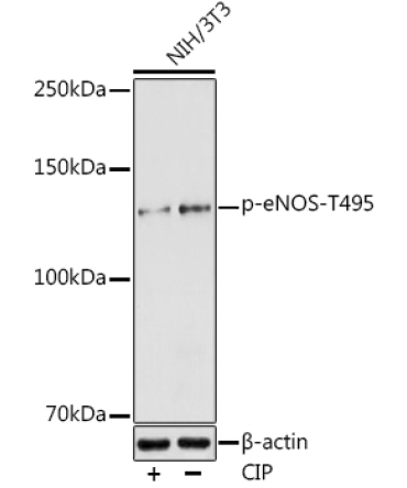 Phospho-eNOS-T495 Rabbit Polyclonal Antibody