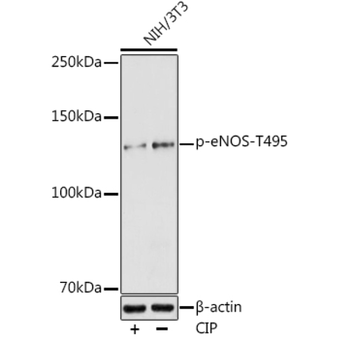 Phospho-eNOS-T495 Rabbit Polyclonal Antibody