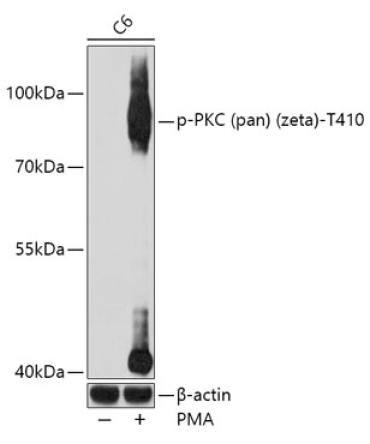 Phospho-PKC (pan) (zeta)-T410 Rabbit Polyclonal Antibody