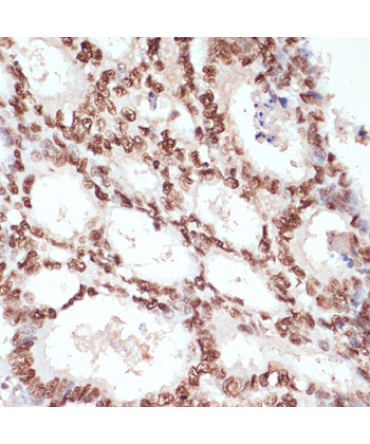 Phospho-Beta-Catenin-S33/S37/T41 Rabbit Polyclonal Antibody