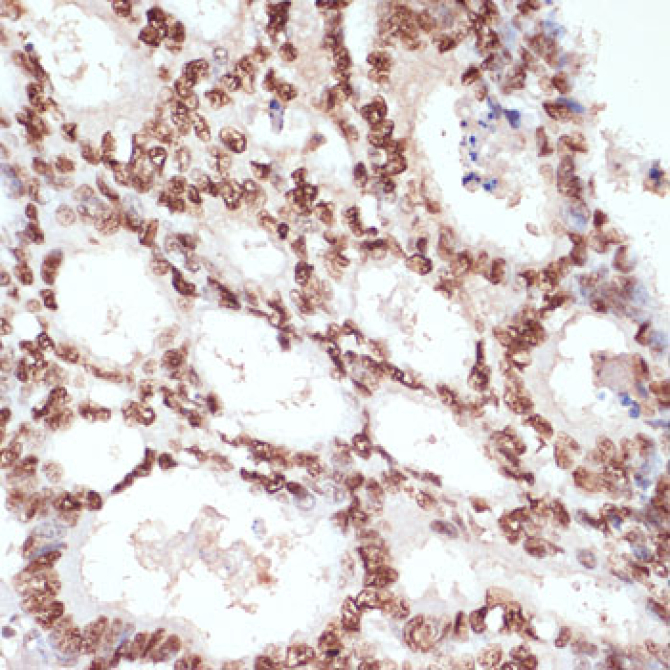 Phospho-Beta-Catenin-S33/S37/T41 Rabbit Polyclonal Antibody