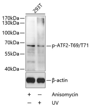 Phospho-ATF2-T69/T71 Rabbit Polyclonal Antibody