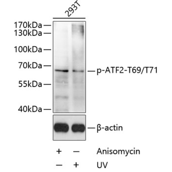 Phospho-ATF2-T69/T71 Rabbit Polyclonal Antibody