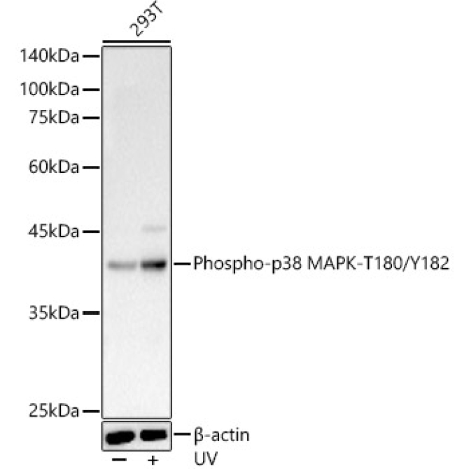 Phospho-p38 MAPK-T180/Y182 Rabbit Polyclonal Antibody