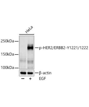 Phospho-HER2/ErbB2-Y1221/1222 Rabbit Polyclonal Antibody