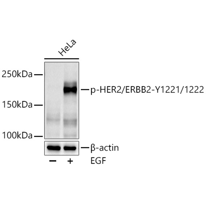 Phospho-HER2/ErbB2-Y1221/1222 Rabbit Polyclonal Antibody