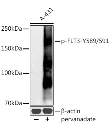 Phospho-FLT3-Y589/591 Rabbit Polyclonal Antibody