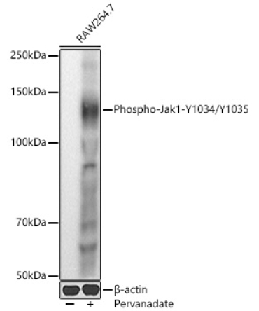 Phospho-Jak1-Y1034/Y1035 Rabbit Polyclonal Antibody
