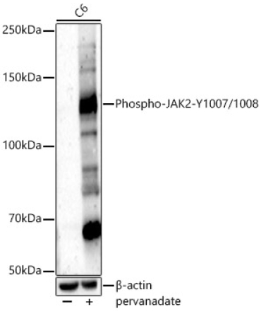 Phospho-JAK2-Y1007/1008 Rabbit Polyclonal Antibody