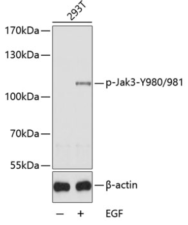 Phospho-Jak3-Y980/981 Rabbit Polyclonal Antibody