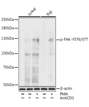 Phospho-FAK-Y576/577 Rabbit Polyclonal Antibody