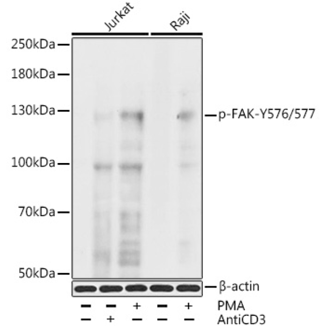 Phospho-FAK-Y576/577 Rabbit Polyclonal Antibody