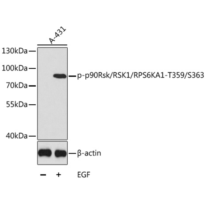 Phospho-p90Rsk/RSK1/RPS6KA1-T359/S363 Rabbit Polyclonal Antibody