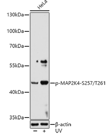 Phospho-MAP2K4-S257/T261 Rabbit Polyclonal Antibody