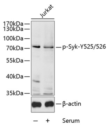 Phospho-Syk-Y525/526 Rabbit Polyclonal Antibody