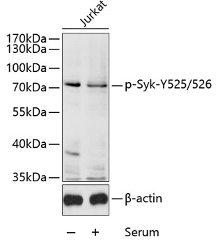 Phospho-Syk-Y525/526 Rabbit Polyclonal Antibody
