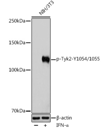 Phospho-Tyk2-Y1054/1055 Rabbit Polyclonal Antibody