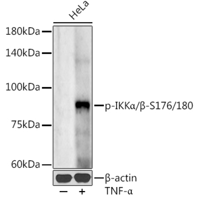 Phospho-IKKAlpha/Beta-S176/180 Rabbit Polyclonal Antibody