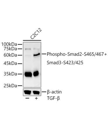 Phospho-Smad2-S465/467 + Smad3-S423/425 Rabbit Polyclonal Antibody